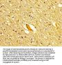 POLD1 Antibody