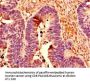 POLR2C Antibody