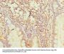 POLR3A Antibody