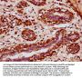 POU3F4 Antibody