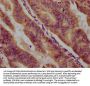 PPCDC Antibody