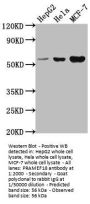 PRAMEF18 Antibody