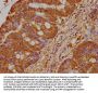 PRAMEF18 Antibody