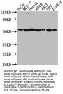 PRAMEF6 Antibody
