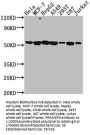 PRAMEF6 Antibody