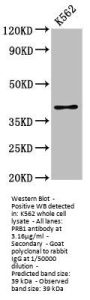 PRB1 Antibody