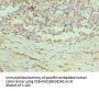 PRDX1 Antibody