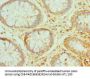 PRDX1 Antibody