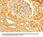 PRDX3 Antibody
