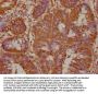 PREP Antibody