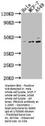 PRKACA Antibody