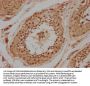 PRKACA Antibody