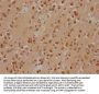 PRKACA Antibody
