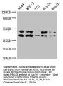 PRKACB Antibody