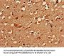 PRKACB Antibody