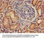 PRKACB Antibody