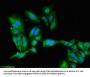 PRKACB Antibody