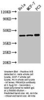 PRKAR2A Antibody