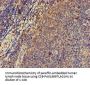 PRKAR2A Antibody