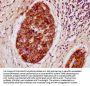 Prl Antibody