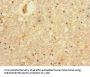 PRMT3 Antibody