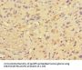 PRMT3 Antibody