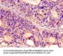 PROKR2 Antibody