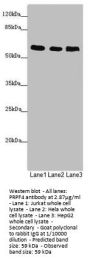 PRPF4 Antibody