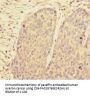 PRPF4 Antibody