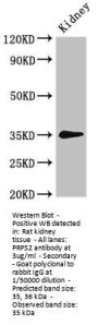 PRPS2 Antibody