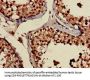 PRPS2 Antibody