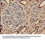 PRPS2 Antibody