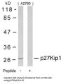 CDKN1B (Ab-10) Antibody