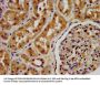 PSAT1 Antibody