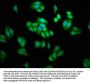 PSAT1 Antibody