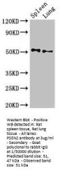 PSEN2 Antibody