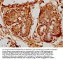 PSMB8 Antibody