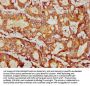 PSMB9 Antibody