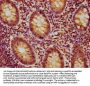 PSMB9 Antibody