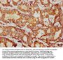 PSMB9 Antibody