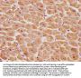 PSMD14 Antibody