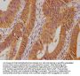 PSMD14 Antibody