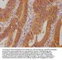 PSMD14 Antibody