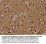 PSMD4 Antibody