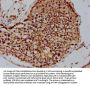 PSMD4 Antibody