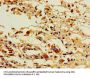 PTGIS Antibody