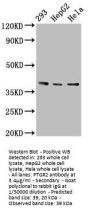 PTGR2 Antibody