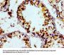 PTGR2 Antibody