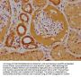PTK7 Antibody