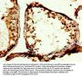 PTPN12 Antibody